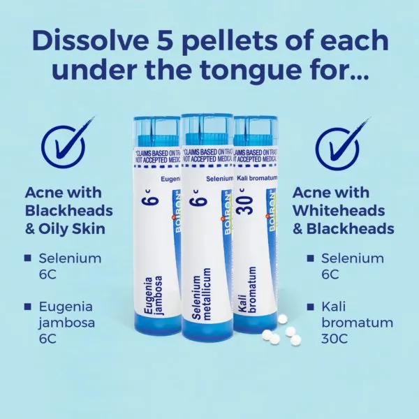 Acne Relief Kit